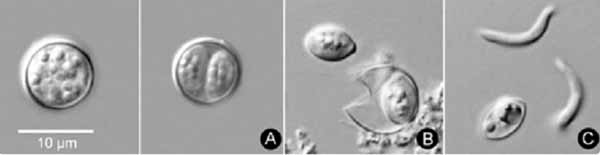 cyclosporiasis cyclosporiasis