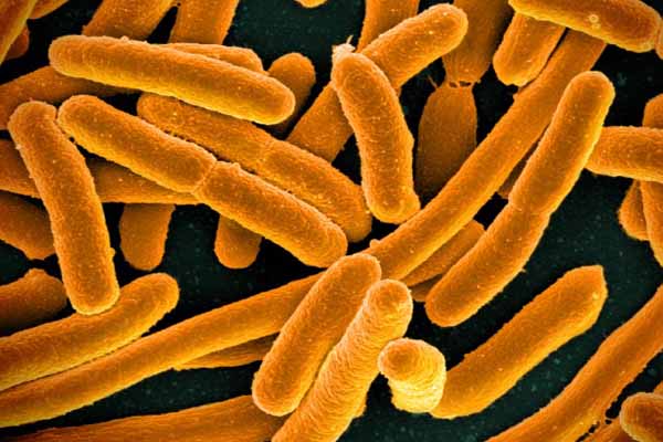 E-Coli E-Coli
