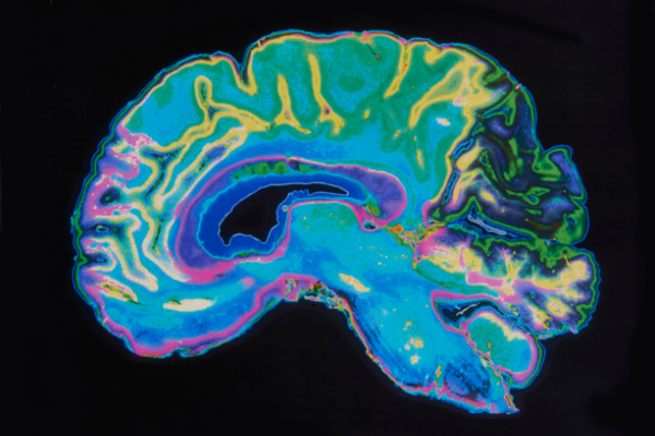 ct_scan_600x400 ct_scan_600x400