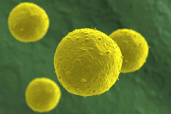 Stem_cell_therapy Stem_cell_therapy